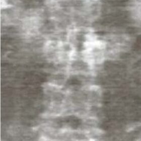 Radiographic Contrast