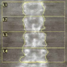 Bra Fasteners