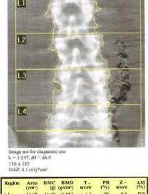 Pelvic Coils
