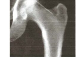 Sewing Needle