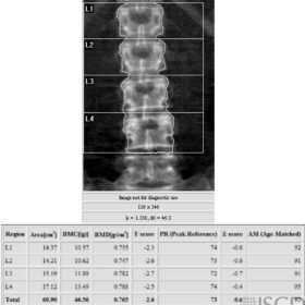 Celiac Disease