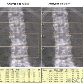 Database/ Ethnicity/ Z-score