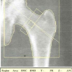 Hip Rotation
