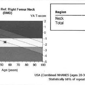 Total Hip Region of Interest Incorrect/GE Healthcare