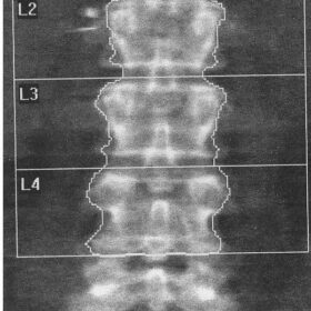 Spine Positioning and Rotation
