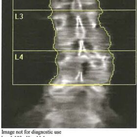 Legs Down vs Legs Up Spine Scan
