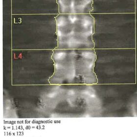 Black Hole Artifact Over L4